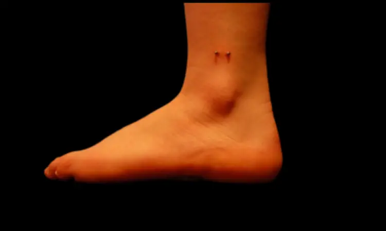 Ankle Piercing Pictures