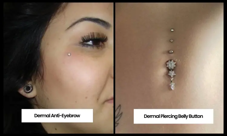 Different Types of Dermal Piercing