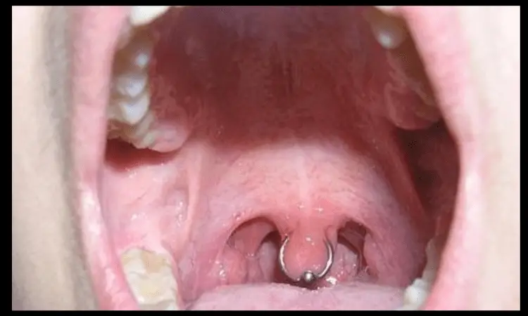 Uvula Piercing Pictures