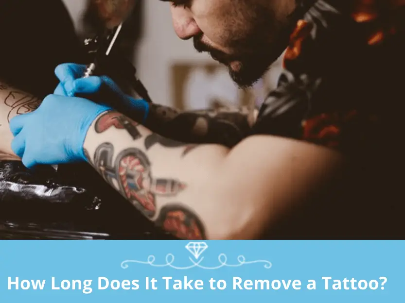 How Long Does It Take to Remove a Tattoo