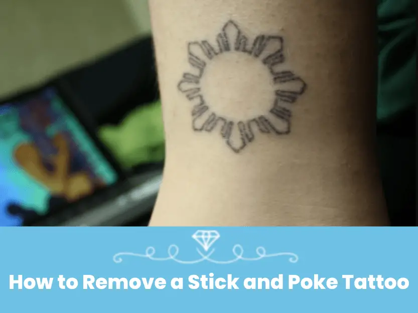 How to Remove a Stick and Poke Tattoo