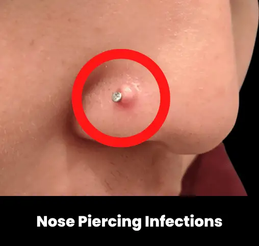 nose piercing healing process pictures